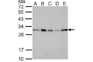 WB Image 14-3-3 sigma antibody detects SFN protein by Western blot analysis.