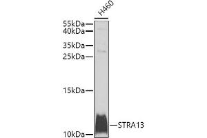 Western blot analysis of extracts of H460 cells, using STR antibody (ABIN6133039, ABIN6148631, ABIN6148632 and ABIN6225238) at 1:1000 dilution. (STRA13 anticorps  (AA 1-63))