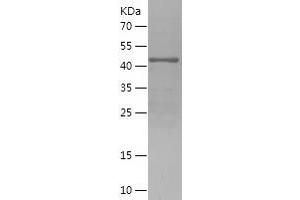 Western Blotting (WB) image for Dachshund 1 (DACH1) (AA 552-758) protein (His-IF2DI Tag) (ABIN7122598)