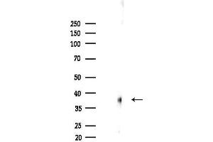 Western blot analysis of lysates from Mouse lung, using SCAR Antibody at 1/1000 dilution.