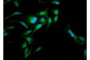Immunofluorescence staining of Hela cells with ABIN7167302 at 1:185, counter-stained with DAPI. (RAB35 anticorps  (AA 1-201))