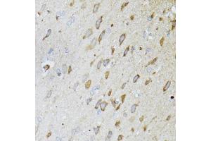 Immunohistochemistry of paraffin-embedded rat brain using ND5 antibody (ABIN5975833) at dilution of 1/100 (40x lens). (MT-ND5 anticorps)