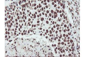 Image no. 7 for anti-Non-POU Domain Containing, Octamer-Binding (NONO) (AA 184-385) antibody (ABIN1491073) (NONO anticorps  (AA 184-385))