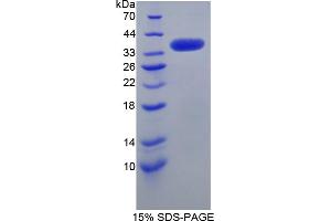Image no. 1 for serine/arginine-Rich Protein Specific Kinase 3 (SRPK3) (AA 247-517) protein (His tag) (ABIN6238289)