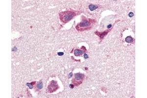 Immunohistochemistry of TRAIL in human brain tissue with this product at 20 μg/ml. (TRAIL anticorps  (C-Term))