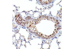Immunohistochemistry of paraffin-embedded mouse lung using BNIP3L Rabbit pAb (ABIN6129989, ABIN6137622, ABIN6137623 and ABIN6221881) at dilution of 1:100 (40x lens). (BNIP3L/NIX anticorps  (AA 1-187))