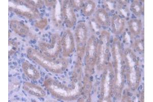 DAB staining on IHC-P; Samples: Rat Kidney Tissue