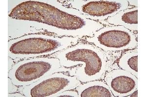 IHC analysis of HOOK3 using anti-HOOK3 antibody (ABIN6719547). (HOOK3 anticorps  (AA 14-198))