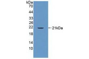 Detection of Recombinant PTPN13, Human using Polyclonal Antibody to Protein Tyrosine Phosphatase, Non Receptor Type 13 (PTPN13)