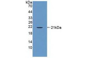 Detection of Recombinant PTPN13, Human using Polyclonal Antibody to Protein Tyrosine Phosphatase, Non Receptor Type 13 (PTPN13) (PTPN13 anticorps  (AA 1-161))
