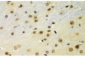 Immunohistochemistry of paraffin-embedded Mouse brain using RNF2 Polyclonal Antibody at dilution of 1:100 (40x lens).