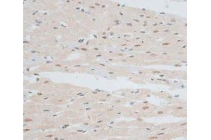 Immunohistochemistry of paraffin-embedded Rat heart using ZNF148 Polyclonal Antibody at dilution of 1:100 (40x lens).