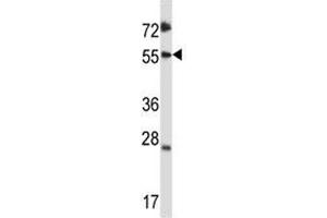 SMAD3 antibody western blot analysis in CEM lysate.