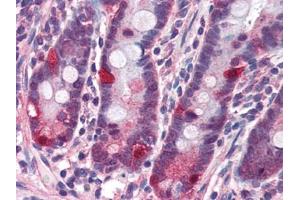 Image no. 1 for anti-Nucleotide-Binding Oligomerization Domain Containing 2 (NOD2) (C-Term) antibody (ABIN372922) (NOD2 anticorps  (C-Term))