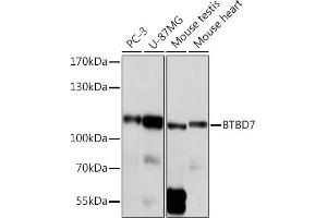 Western blot analysis of extracts of various cell lines, using BTBD7 Rabbit pAb (ABIN7265954) at 1:1000 dilution.