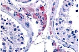 Anti-ESRRB antibody  ABIN1048582 IHC staining of human testis. (ESRRB anticorps  (Internal Region))