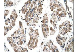 Image no. 1 for anti-Integrin beta 1 Binding Protein (Melusin) 2 (ITGB1BP2) (N-Term) antibody (ABIN204995)