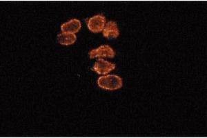 Immunofluorescence staining of SKN cells (human neuroblastoma). (Cyclin B1 anticorps  (AA 14-168))