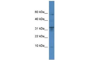 WB Suggested Anti-CTSC Antibody Titration: 0.