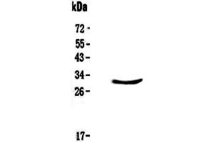 Western blot analysis of CLPP using anti-CLPP antibody .