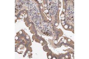 Immunohistochemical staining of human duodenum with B3GNTL1 polyclonal antibody  shows moderate cytoplasmic positivity in glandular cells. (B3GNTL1 anticorps)