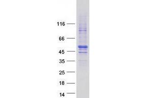 Validation with Western Blot