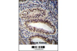 PGR/PR Antibody immunohistochemistry analysis in formalin fixed and paraffin embedded human uterus tissue followed by peroxidase conjugation of the secondary antibody and DAB staining.