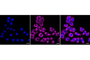anti-Sterol Carrier Protein 2 (SCP2) antibody