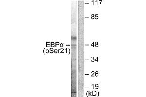 Western blot analysis of extracts from HepG2 cells treated with EGF (200ng/ml, 5mins), using C/EBP-α (phospho-Ser21) antibody. (CEBPA anticorps  (pSer21))
