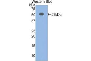Detection of Recombinant aFP, Rat using Polyclonal Antibody to Alpha-Fetoprotein (AFP)