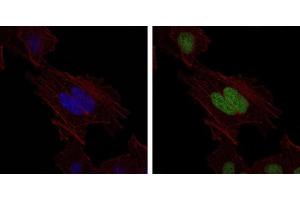 Immunofluorescence analysis of Hela cells using MSH6 mouse mAb (green).