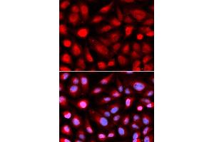 Immunofluorescence analysis of U2OS cell using RPL5 antibody. (RPL5 anticorps  (AA 1-95))