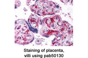 Image no. 1 for anti-Hypoxia Inducible Factor 1, alpha Subunit (Basic Helix-Loop-Helix Transcription Factor) (HIF1A) (AA 530-825) antibody (ABIN363439)