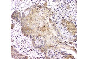 IHC analysis of RAB11B using anti-RAB11B antibody (ABIN6719364). (RAB11B anticorps)