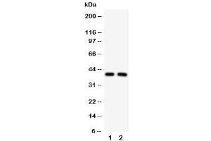 Western blot testing of IRF2 antibody and Lane 1:  HeLa (IRF2 anticorps  (C-Term))