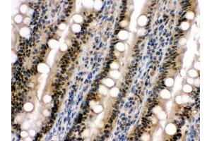 Immunohistochemistry (Paraffin-embedded Sections) (IHC (p)) image for anti-Mitogen-Activated Protein Kinase 13 (MAPK13) (AA 332-365), (C-Term) antibody (ABIN3043610)