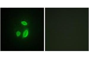 Immunofluorescence analysis of HuvEc cells, using SEPARASE (Ab-801) Antibody. (Separase anticorps  (AA 767-816))