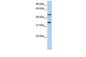 anti-Interaction Protein For Cytohesin Exchange Factors 1 (IPCEF1) (AA 254-303) antibody