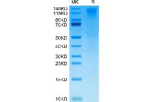 Biotinylated Human CD96 on Tris-Bis PAGE under reduced condition. (CD96 Protein (CD96) (AA 22-503) (His-Avi Tag,Biotin))