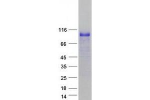Validation with Western Blot