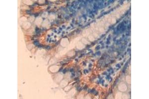 IHC-P analysis of Kidney tissue, with DAB staining. (TPSB2 anticorps  (AA 30-276))