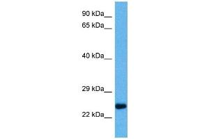Host:  Mouse  Target Name:  PLP1  Sample Tissue:  Mouse Heart  Antibody Dilution:  1ug/ml