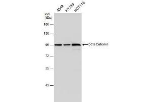 WB Image beta Catenin antibody [N1N2-2], N-term detects beta Catenin protein by western blot analysis. (CTNNB1 anticorps  (N-Term))
