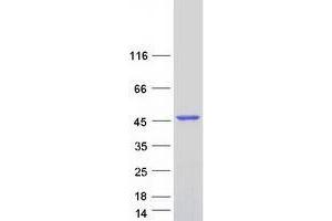 Validation with Western Blot
