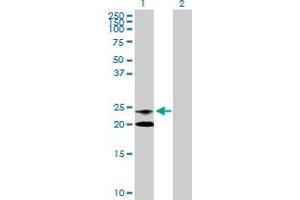 Western Blot analysis of NAAA expression in transfected 293T cell line by NAAA MaxPab polyclonal antibody.
