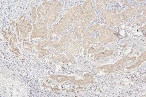 IHC analysis of SEMA3B using anti-SEMA3B antibody (ABIN6719617).