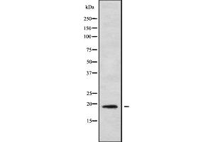 Western blot analysis IL1F9 using COLO205 whole cell lysates (IL1F9 anticorps  (N-Term))