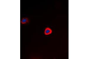 Immunofluorescent analysis of PAK1 (pT212) staining in Hela cells. (PAK1 anticorps  (pSer212))