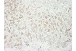 Immunohistochemistry (IHC) image for anti-Ubiquitin Specific Peptidase 37 (USP37) (AA 125-175) antibody (ABIN7454380)