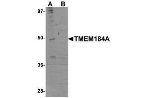 Western blot analysis in rat brain tissue lysate with TMEM184A Antibody  at 1 μg/ml in the absence (A) and the presence (B) of blocking peptide. (TMEM184A anticorps  (C-Term))